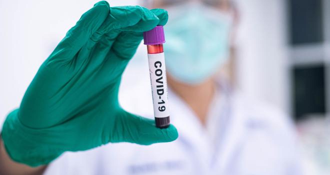 Pour les personnes qui présentent les symptômes du Covid-19, la MSA prend en charge à 100 % le test prescrit par le médecin. CP : Near/Adobe Stock